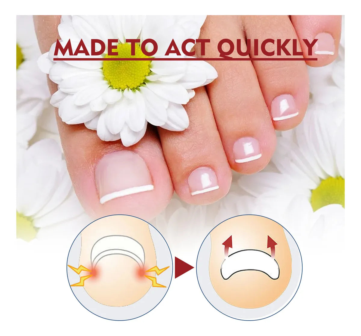 Super Oferta 2 x 1 Aceite Antiparoniquia Soft Bright Nail Repair®