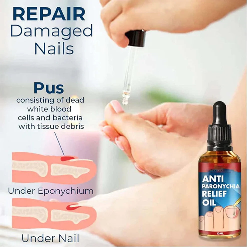 Super Oferta 2 x 1 Aceite Antiparoniquia Soft Bright Nail Repair®